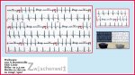 Webware EKG Linie Herzschlag weiß